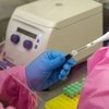 Вирус лошадиного энцефалита может стать опасным для человека